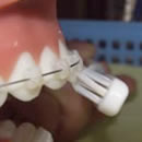 ブラケットの下側