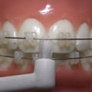 ワンタフトブラシ